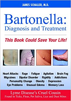 Bartonella: Diagnosis and Treatment (Dhivehi Edition ...