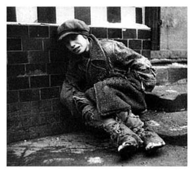Starving Boy in 1930’s Germany | World Wars Blog